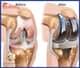 Slider image (6) Dr. Jose Manuel Hernandez - Orthopedic Surgery in Mexico